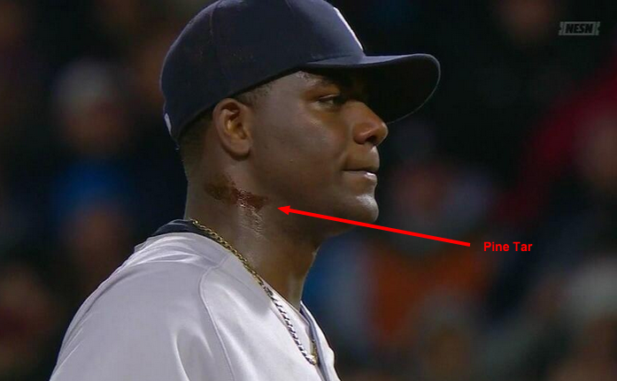 Michael Pineda cheats with pine tar on his neck